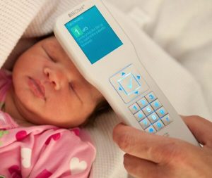 دستگاه بیلی روبین تست زردی نوزاد بدون خونگیری